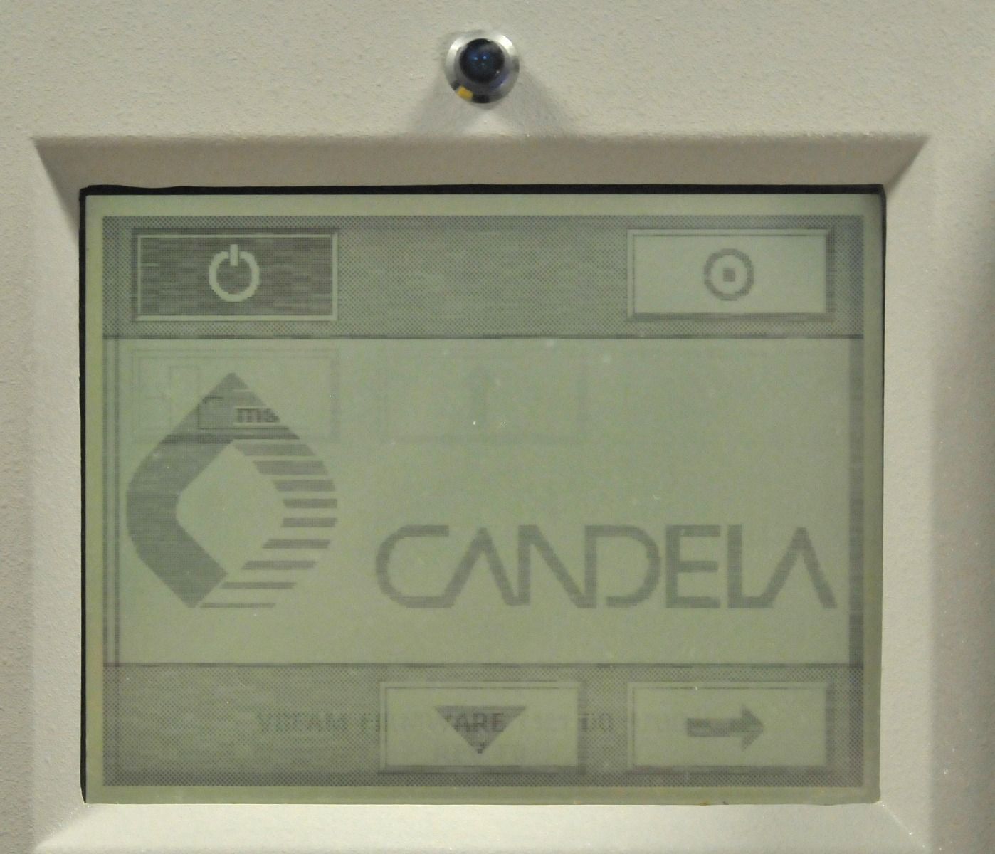 2003 Candela VBeam Laser Lesions Vascular Wrinkles PDL Pulsed Dye V Beam System