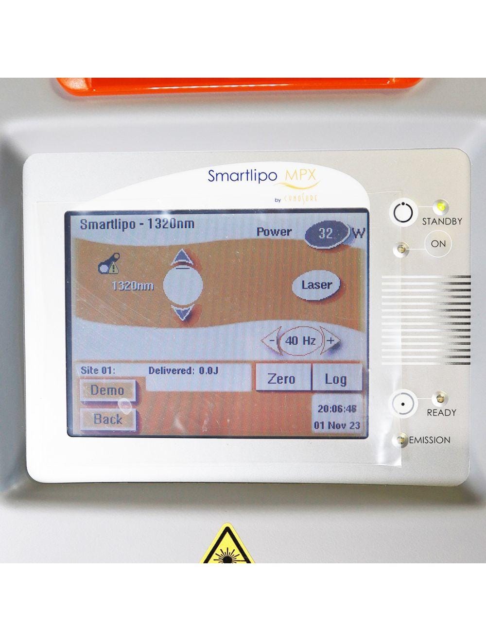 2015 Cynosure Smartlipo MPX 1064nm 1320nm Nd YAG Laser Body Sculpting Non-RFID