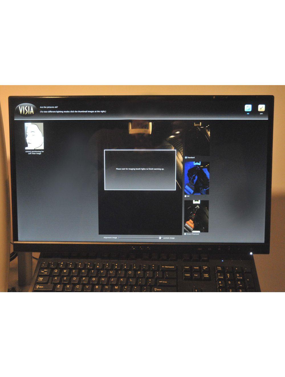 Canfield Scientific VISIA Facial Imaging System - Complexion Analysis Skin Care Sol International Medical