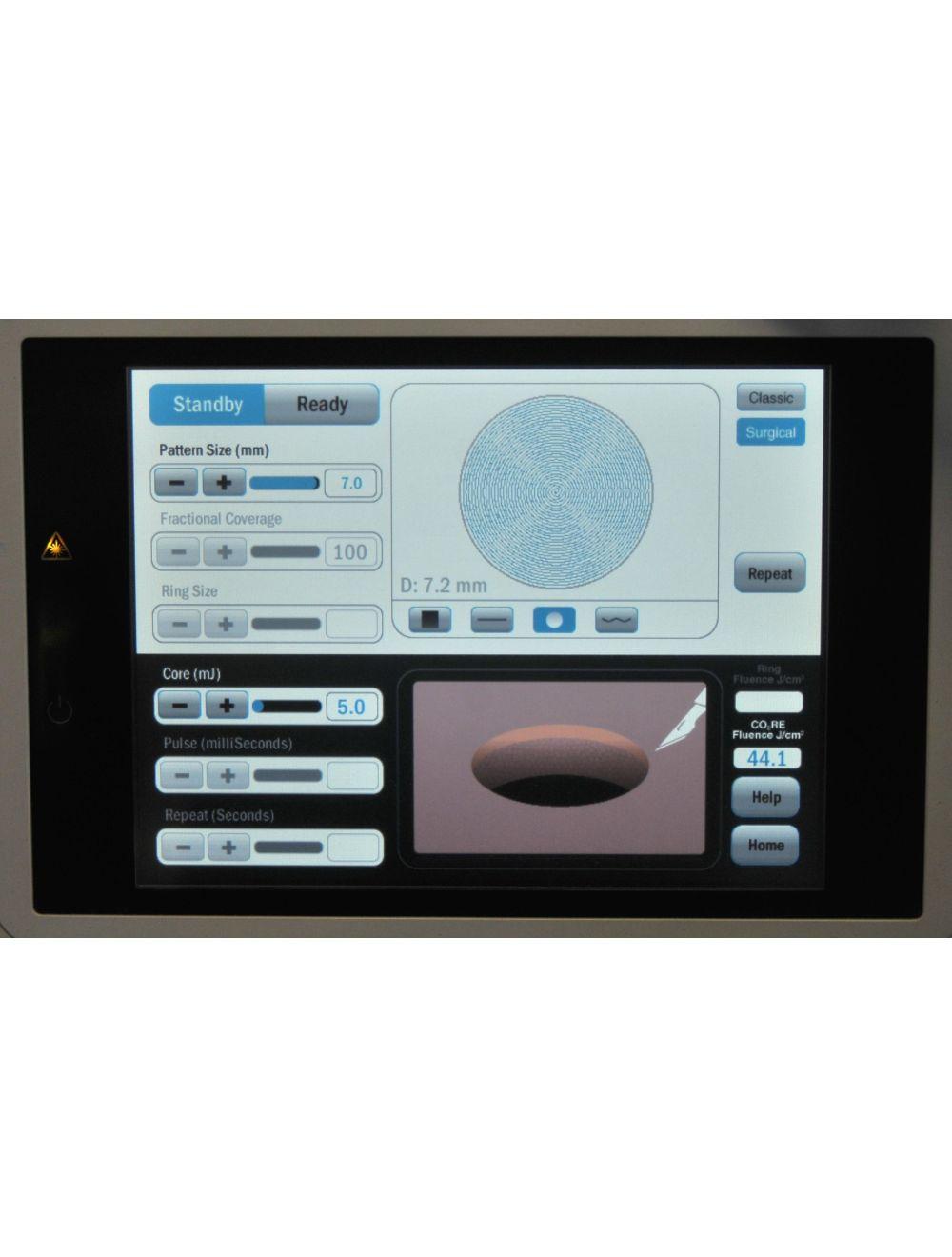 2012 Syneron Candela CO2RE Intima CO2 Laser Wrinkle Reduction Skin Resurfacing Candela