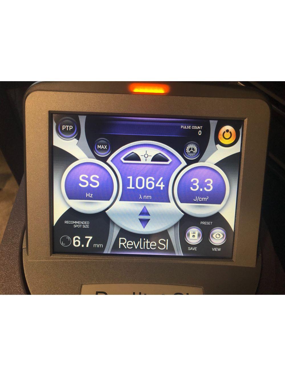 2021 Cynosure RevLite SI Q-Switched Laser System 532nm 1064nm Tattoo Removal