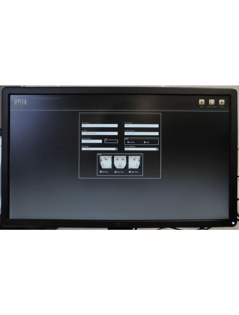 Canfield Scientific Visia Skin Care Facial Complexion Analysis Imaging Photo