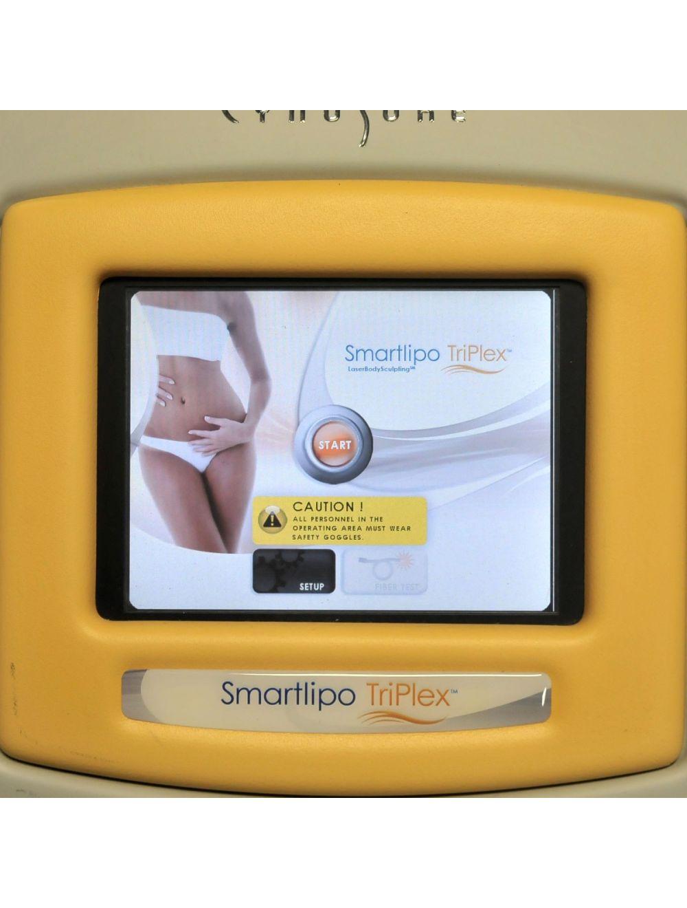 2014 Cynosure SmartLipo Triplex SLT II 1064 1320 1440 Laser Tri Plex Lipolysis Cynosure
