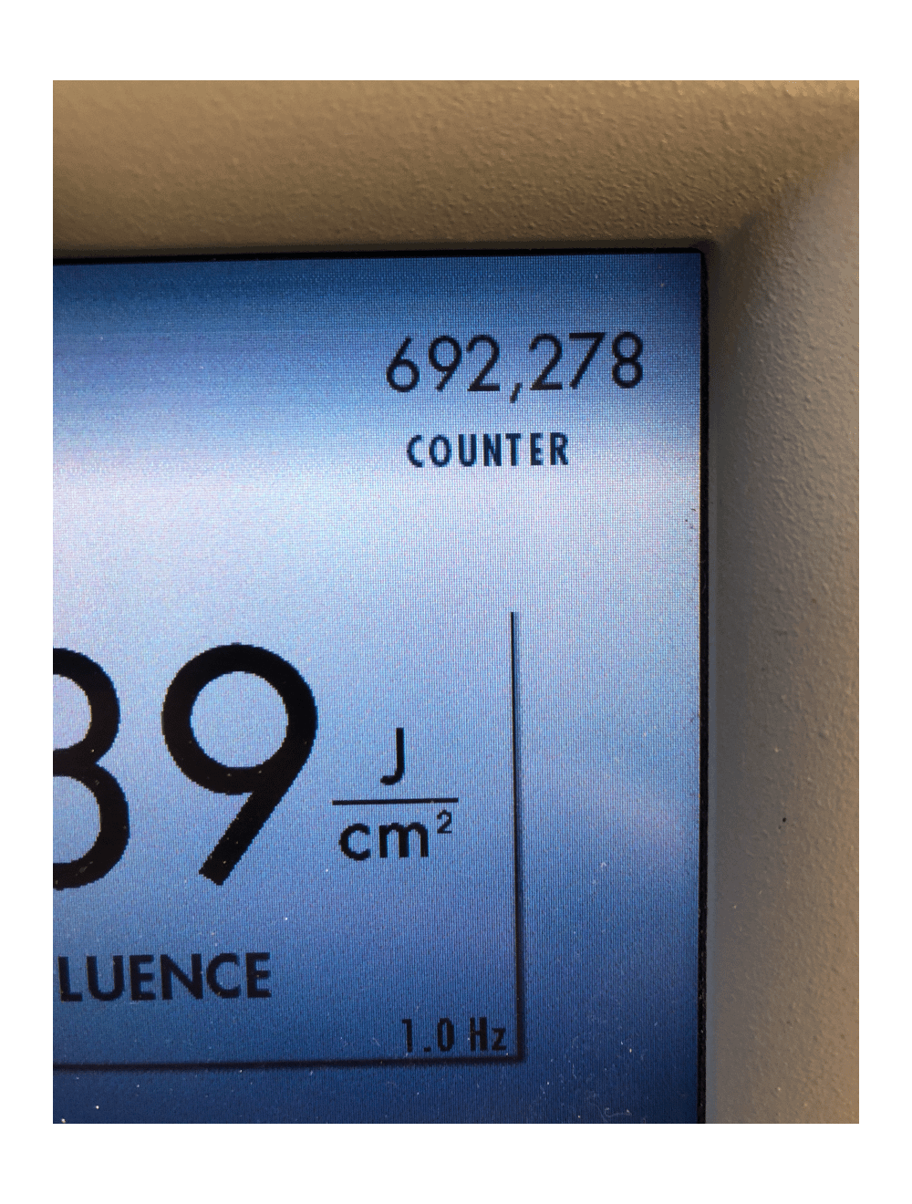 Lumenis LightSheer SC Diode 810 Hair Removal Laser System 9x9 mm HR LightSheer